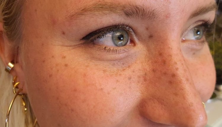 Sommersprossen_Permanent_Make-up_Wien_Wioletta_Dabrowski